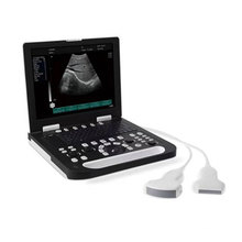 Full-digital Laptop Ultrasound Scanner